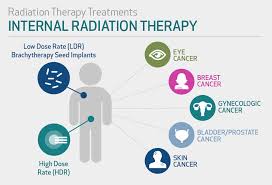 Although it is the most commonly diagnosed cancer in american women, breast cancer can impact people of all genders. Radiation Therapy Houston Methodist