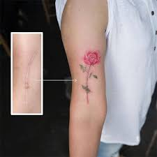 Keloid removal treatment works by shrinking the keloid. Tattooing Scars And Stretchmarks Timeless Tattoo 2021