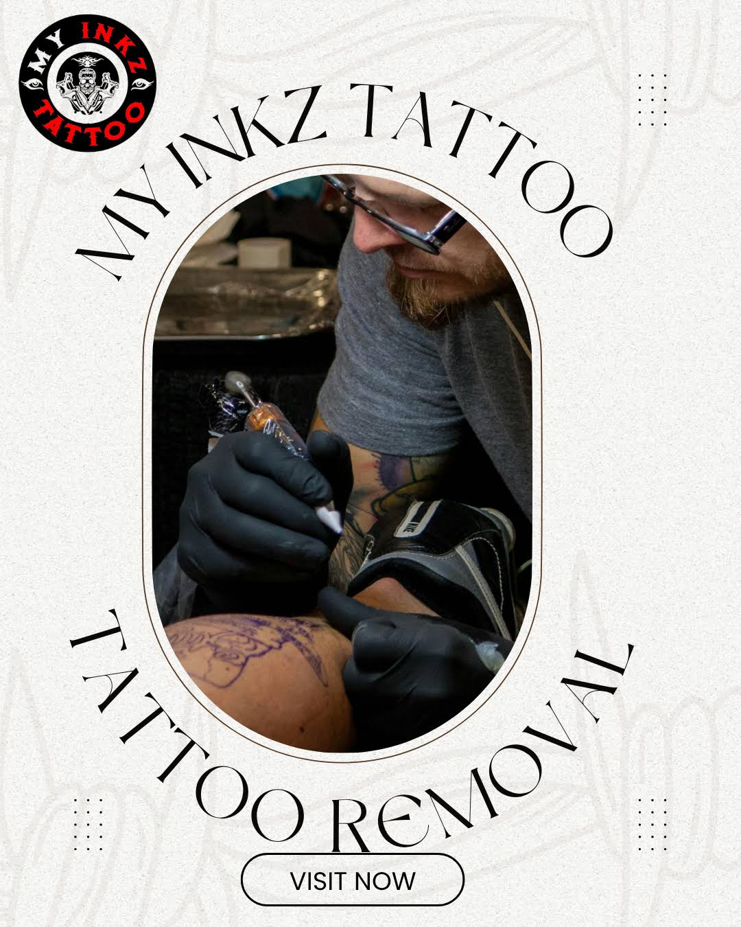 Tattoo Removal Near me product image