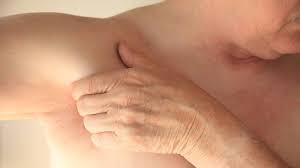 The most common areas affected include larger skin. Jlsdgermtjcqwm