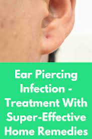 Ear Piercing Infection Treatment With Super Effective Home Remedies Any Kind Of Piercings Involve Ear Piercing Infection Piercing Infection Ear Piercing Care