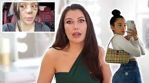 Song written by cristina villegas copyright © 2020 tinavinc. Cristina Villegas My Botched Nose Job Vlog My Reaction Youtube