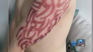 Are temporary henna tattoos safe health. Virginia Boy Suffers Allergic Reaction From Black Henna Tattoo Youtube