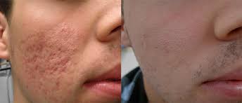 Image result