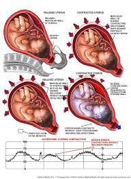 Pitocin is not just used to induce labor. Pitocin Oxytocin Labor Induction And Potential Risks