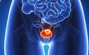 They also do tests to le. Clinical Trial Using Mri For Prostate Cancer Diagnosis Equals Or Beats Current Standard Ecancer