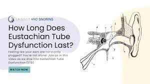 Image result for Eustachian Tube Dysfunction