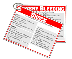 Shock And Severe Bleeding First Aid Basics Simple Family Preparedness First Aid Tips First Aid Basic First Aid
