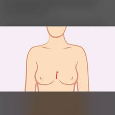 Druck Auf Der Brust Mittig Gesundheit Und Medizin Herz