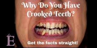 Fortunately, we have the technology today to fix crooked teeth and make your smile look its best! What Causes Crooked Teeth Dr E Helps Get The Facts Straight