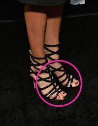 Meghan Markle S Feet Have Everyone Talking Right Now Feet Foot Remedies Celebrity Feet