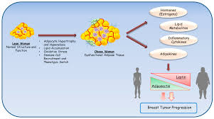 Obesity, Leptin and Breast Cancer: Epidemiological Evidence and Proposed  Mechanisms