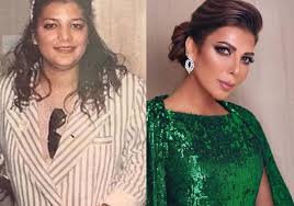 هل اقتصر الأمر على عمليتين؟ Ù†Ø¬Ù…Ø§Øª Ø¹Ø±Ø¨ÙŠØ§Øª Ù†Ø¯Ù…Ù† Ø¹Ù„Ù‰ Ø¹Ù…Ù„ÙŠØ§Øª Ø§Ù„ØªØ¬Ù…ÙŠÙ„ Yasmina