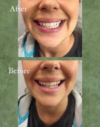 Hope you all are enjoying your day! Have any of you thought about becoming  a teeth whitening professional?