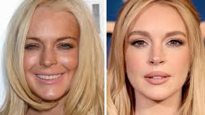 Lindsay Lohan's remarkable transformation explained