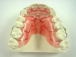 A guide to eating with braces. Parks Dental Orthodontics Lab Orthodontics Dental Orthodontics Dental