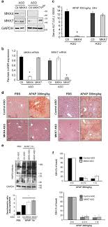Transaction, fine, and suspension data since 2015. The Role Of Map2 Kinases And P38 Kinase In Acute Murine Liver Injury Models Cell Death Disease