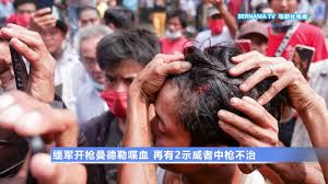 10 points11 points12 points submitted 2 months ago by lx881219. 20210221 ç¼…å†›å¼€æžªæ›¼å¾·å‹'å–‹è¡€å†æœ‰2ç¤ºå¨è€…ä¸­æžªä¸æ²» Youtube