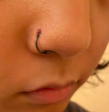 Nose Piercing Bump I Think It S Titanium But Not Sure I Use The Neilmed Piercing After Care Spray Twice Daily The Bump Appeared About A Week After I Got It And