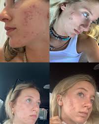 Mary Reith 😎🐙⚡️🥑⛺️ (@healthwmaryreith) • Instagram photos and videos