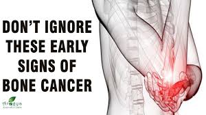 The survival rates vary depending on the exact type of bone cancer and the prognosis for the disease. Don T Ignore These Early Signs Of Bone Cancer Symptoms Of Bone Cancer Youtube
