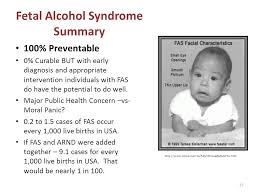 Fetal Alcohol Syndrome Ppt Video Online Download