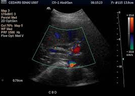 We did not find results for: Abdominal Ultrasound Cedars Sinai