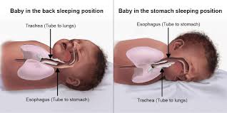 Baby S Anatomy When On The Stomach And On The Back Reflux Baby Baby Sleep Stomach Sleeping