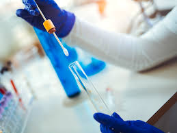 Image result for Prenatal Lab