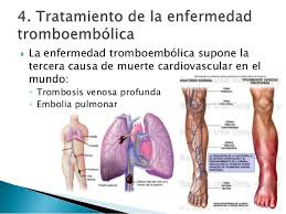 La trombosis venosa profunda, también llamada tvp, es un coágulo de sangre que se forma dentro de una vena en el cuerpo. Trombosis Venosa Profunda Espana Photos Facebook