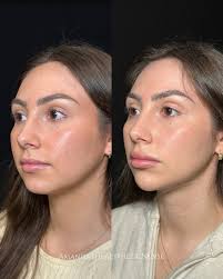 Amanda Solar BSN, RN (@amandatheaestheticnurse) • Instagram photos and  videos