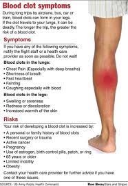 Pin On X Blood Clot Symptoms