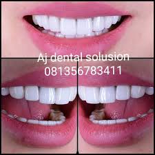 Pegangan untuk gigi palsu in english. Aj Dental Solusion Dental Aj Twitter