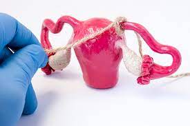 What Are The Pros And Cons Of Tubal Ligation