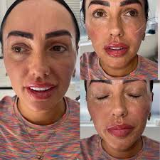 Results using cheek cogs, not...