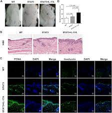 IL-17A exacerbates psoriasis in a STAT3 overexpressing mouse model [PeerJ]