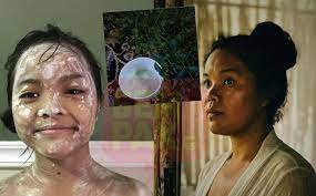Daun semambu biasanya digunakan sebagai penawar demam campak pada manusia. Anak Demam Campak Farah Ahmad Tetap Guna Petua Orang Dulu Tepek Daun Semambu Gempak