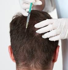 فوائد الكولاجين للرجال الاستخدامات للبشرة والشعر تجميلي