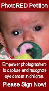 Researchers determined the sensitivity, specificity and accuracy of the prototype by analysing more than 50,000 photographs of children taken before their diagnosis. Retinoblastoma
