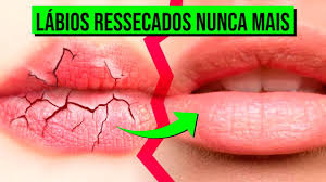 Adeus Labios Ressecados E Rachados Aprenda Esse Tratamento Caseiro E Rapido Youtube