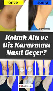 Kararmis Koltuk Altlari Ve Kararmis Dizler Nasil Beyazlatilir Schonh Altlari Beyazlatilir Dizler Kararmis Koltuk Alti Dogal Cilt Bakimi Dogal Cilt