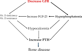 Image result for Hyperparathyroidism