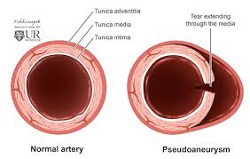 Image result for Pseudoeriosema