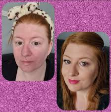 Quick redness concealing skin products needed