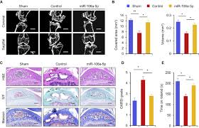 It can set alarms, answer your questions, read news, connect to saavn and other streaming services, all by using your voice. Cryptotanshinone Protects Cartilage Against Developing Osteoarthritis Through The Mir 106a 5p Glis3 Axis Sciencedirect