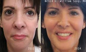 Lowenstein sandler represented acrew capital in the transaction. Omni Aesthetics 169 Ramapo Valley Rd Oakland Nj Nursing Personal Care Nec Mapquest