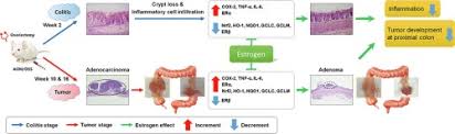 It usually begins as small, noncancerous (benign) clumps of cells called polyps many people with colon cancer experience no symptoms in the early stages of the disease. Effects Of 17b Estradiol On Colorectal Cancer Development After Azoxymethane Dextran Sulfate Sodium Treatment Of Ovariectomized Mice Sciencedirect