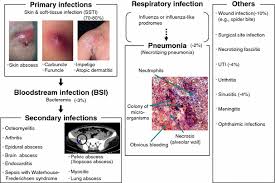 Алгоритм выбора абп при cre. Community Acquired Methicillin Resistant Staphylococcus Aureus Community Transmission Pathogenesis And Drug Resistance Springerlink