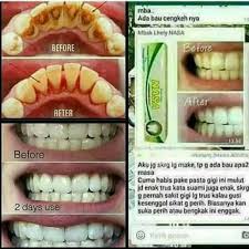 Testimoni Pasta Gigi Nasa Shopee Indonesia