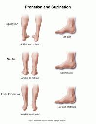 Summit Medical Group Over Pronation Pronation Hip Flexor Foot Health